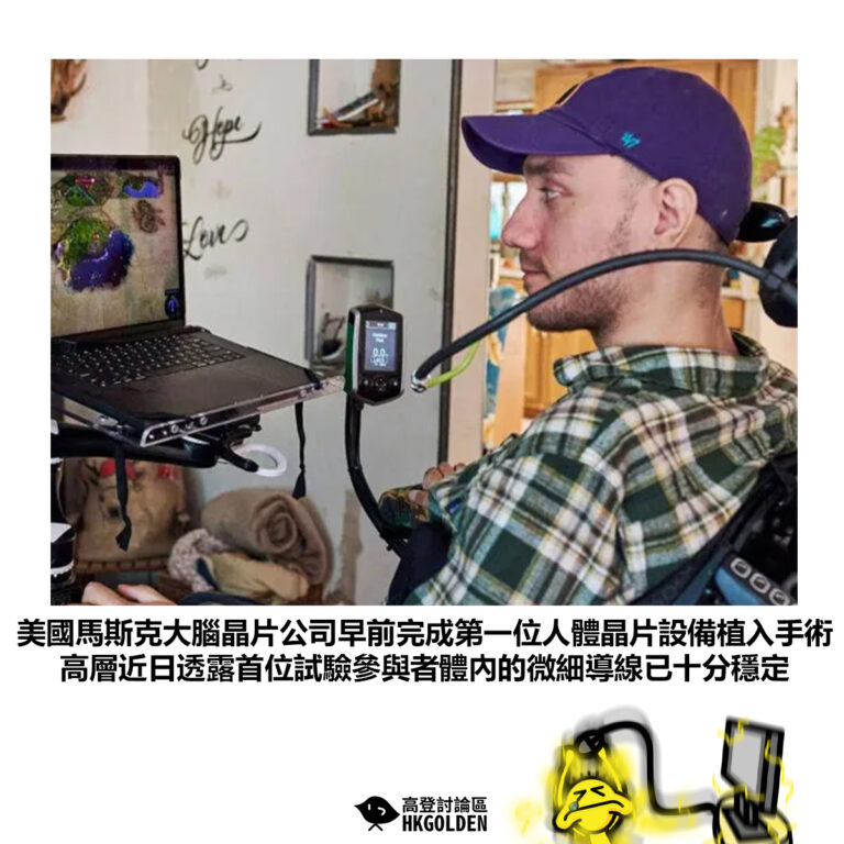 【美國馬斯克大腦晶片公司早前完成第一位人體晶片設備植入手術高層近日透露首位試驗參與者體內的微細導線已十分穩定】