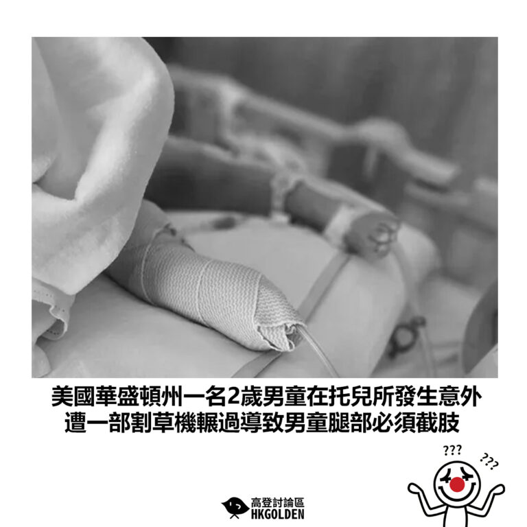 【美國華盛頓州一名2歲男童在托兒所發生意外 遭部割草機輾過導致男童腿部必須截肢】