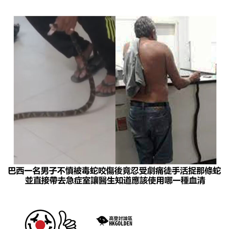 【巴西一名男子不慎被毒蛇咬傷後竟忍受劇痛徒手活捉那條蛇 並直接帶去急症室讓醫生知道應該使用哪一種血清】