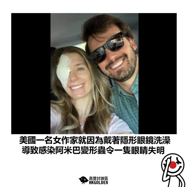 【美國一名女作家就因為戴著隱形眼鏡洗澡 導致感染棘變形蟲角膜炎令一隻眼睛失明 】