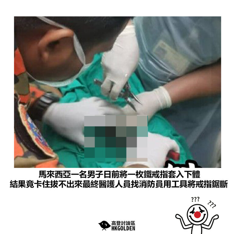 【馬來西亞一名男子日前將一枚鐵戒指套入下體 結果竟卡住拔不出來最終醫護人員找消防員用工具將戒指鋸斷】