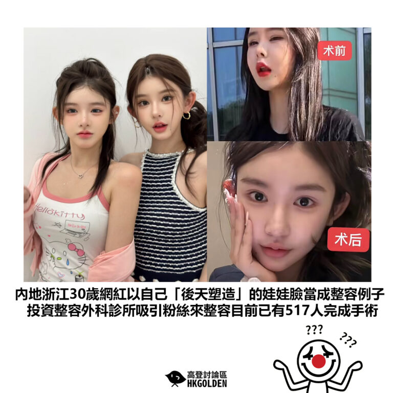 【內地浙江30歲網紅以自己「後天塑造」的娃娃臉當成整容例子 投資整容外科診所吸引粉絲來整容目前已有517人完成手術】