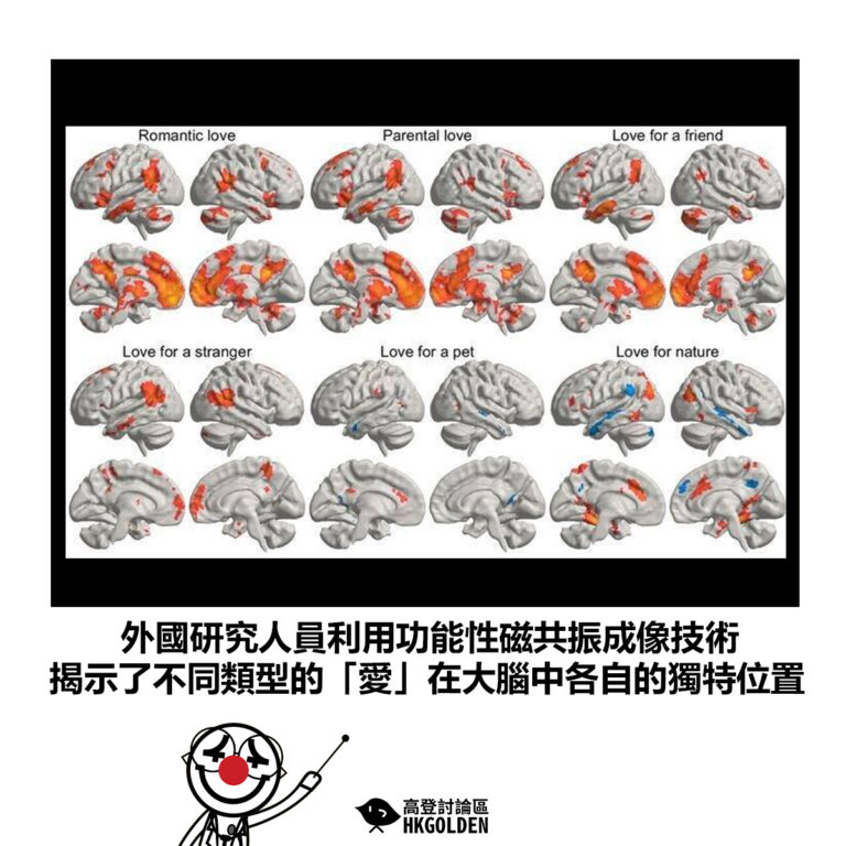 【外國研究人員利用功能性磁共振成像技術 揭示了不同類型的「愛」在大腦中各自的獨特位置】