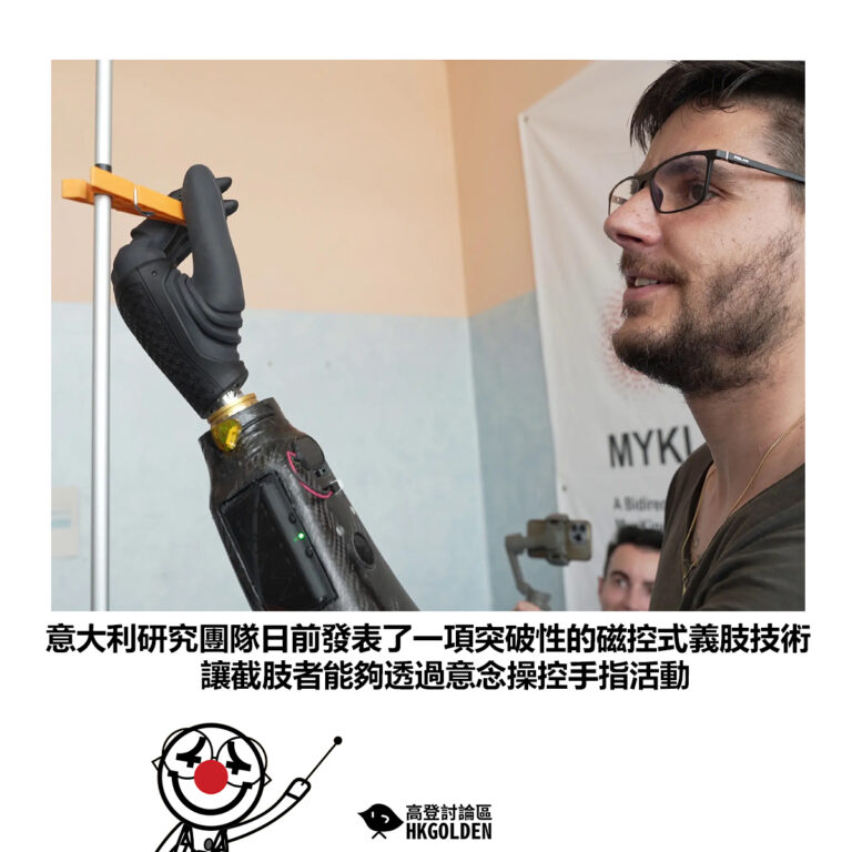 【意大利研究團隊日前發表了一項突破性的磁控式義肢技術 讓截肢者能夠透過意念操控手指活動】