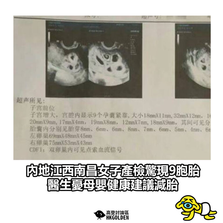 【內地江西南昌女子產檢驚現9胞胎　醫生憂母嬰健康建議減胎】