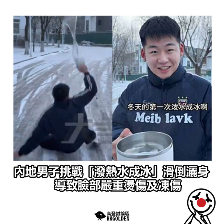 【內地男子挑戰「潑熱水成冰」滑倒灑身 導致臉部嚴重燙傷及凍傷】