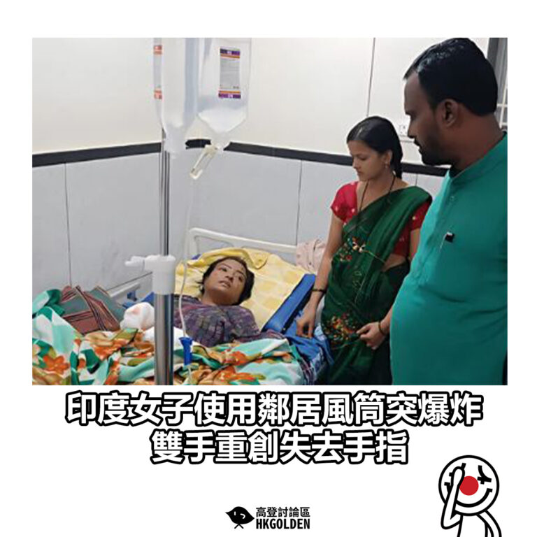 【印度女子使用鄰居風筒突爆炸 雙手重創失去手指】