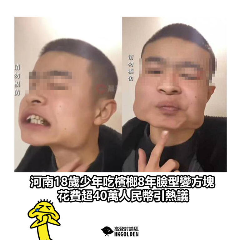 【河南18歲少年吃檳榔8年臉型變方塊 花費超40萬人民幣引熱議】