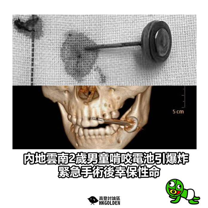 sdgsdgsgsag