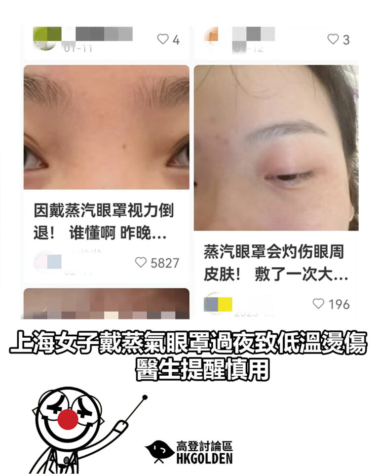 【上海女子戴蒸氣眼罩過夜致低溫燙傷 醫生提醒慎用】