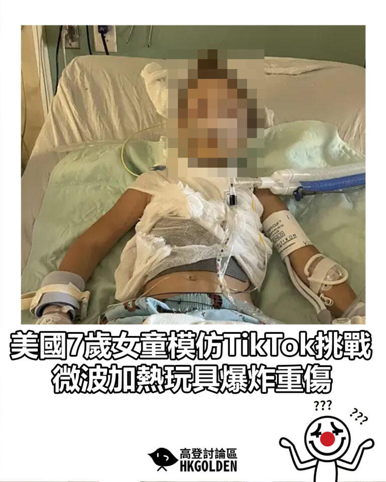 【美國7歲女童模仿TikTok挑戰 微波加熱玩具爆炸重傷】