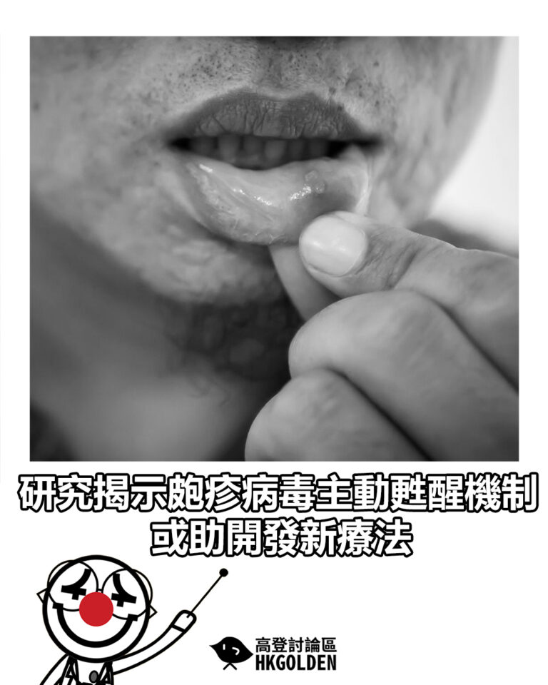 【研究揭示皰疹病毒主動甦醒機制 或助開發新療法】