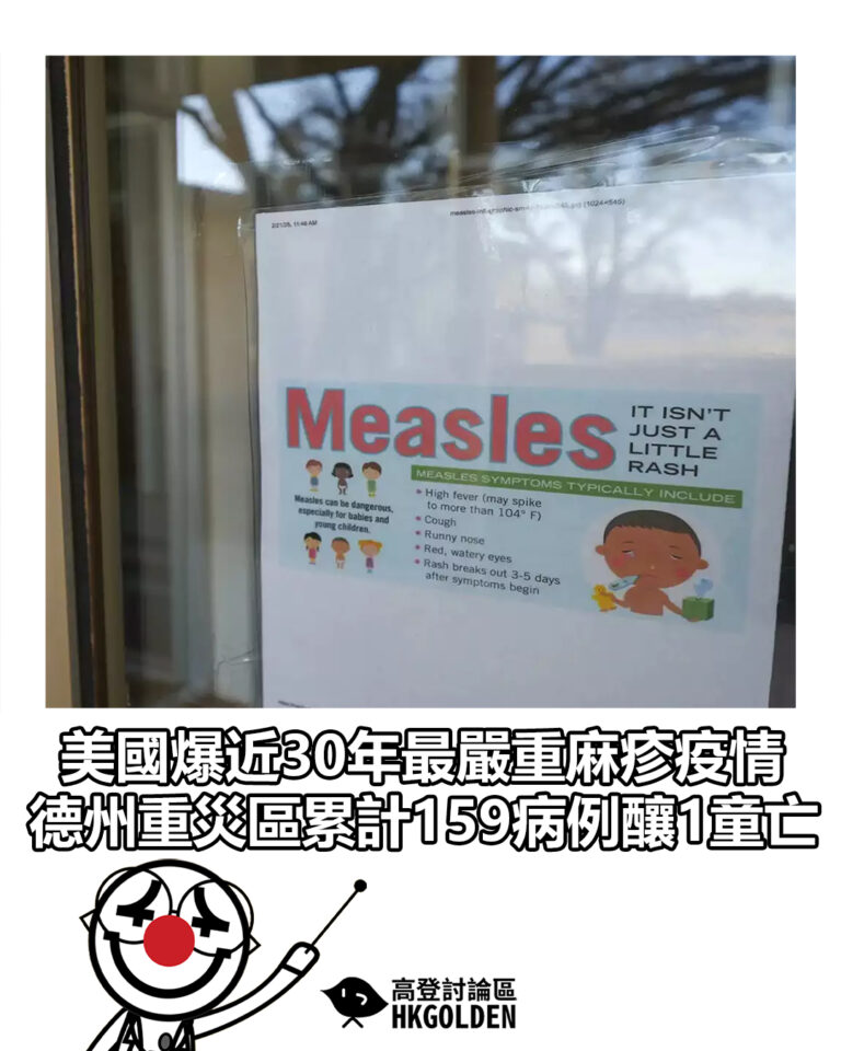 【美國爆近30年最嚴重麻疹疫情　德州重災區累計159病例釀1童亡】