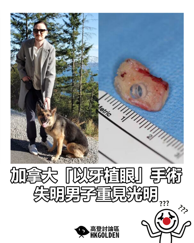 【加拿大「以牙植眼」手術  失明男子重見光明】