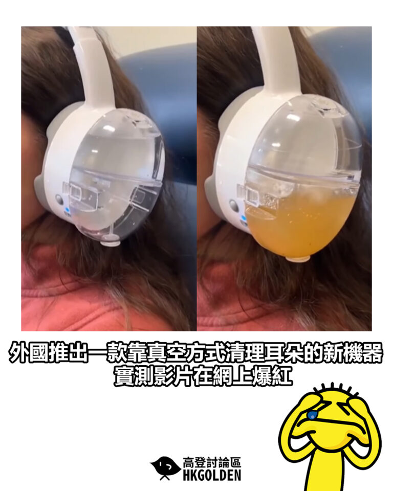 【外國推出一款靠真空方式清理耳朵的新機器 實測影片在網上爆紅】