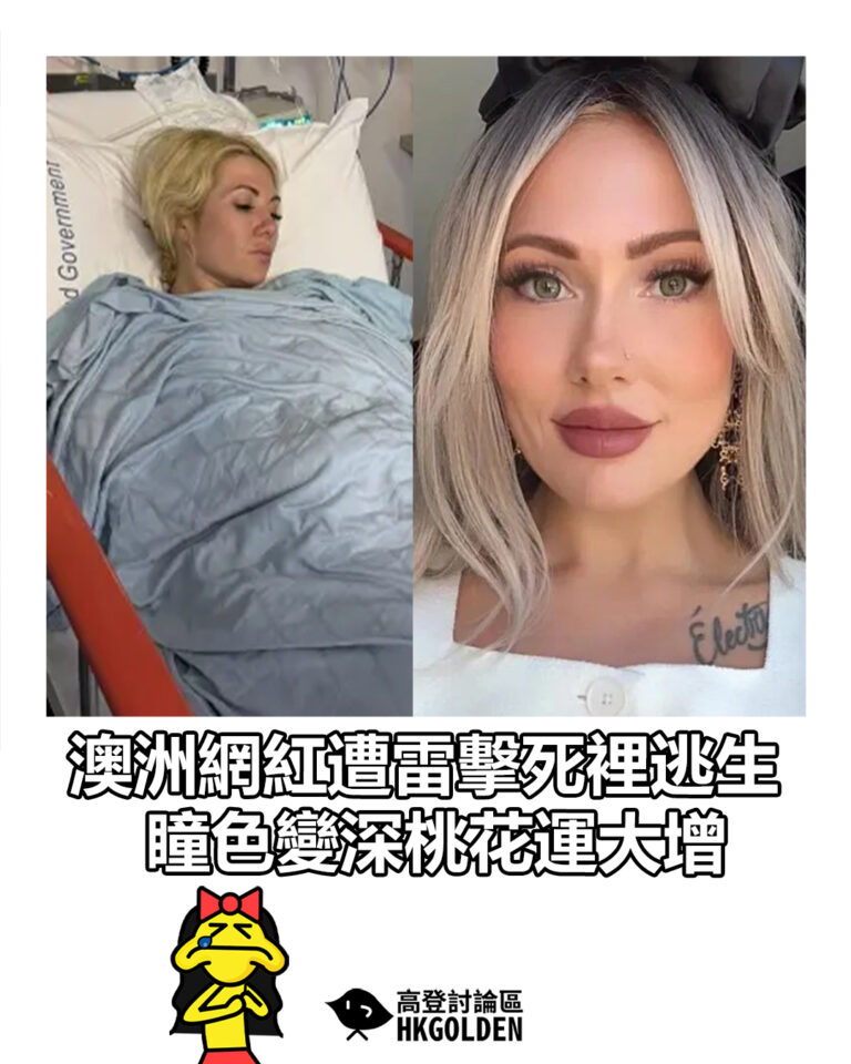 【澳洲網紅遭雷擊死裡逃生 瞳色變深桃花運大增】