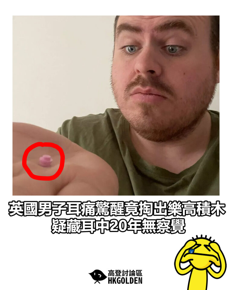 【英國男子耳痛驚醒竟掏出樂高積木　疑藏耳中20年無察覺】