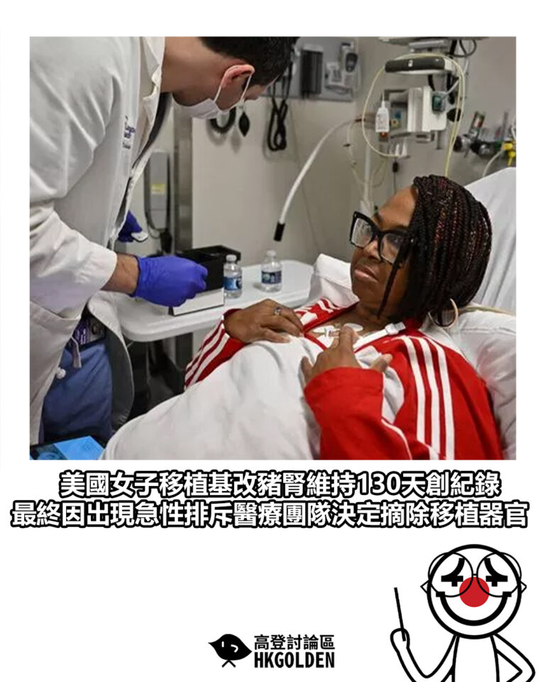 【美國女子移植基改豬腎維持130天創紀錄　最終因出現急性排斥醫療團隊決定摘除移植器官】