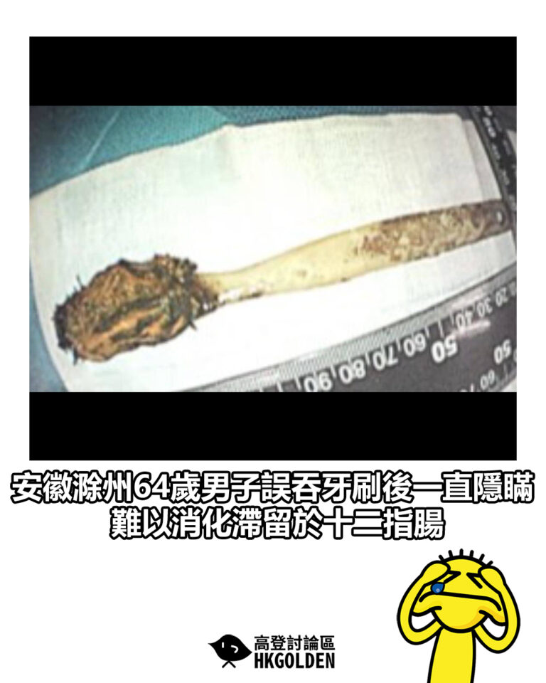 【安徽滁州64歲男子誤吞牙刷後一直隱瞞 難以消化滯留於十二指腸】