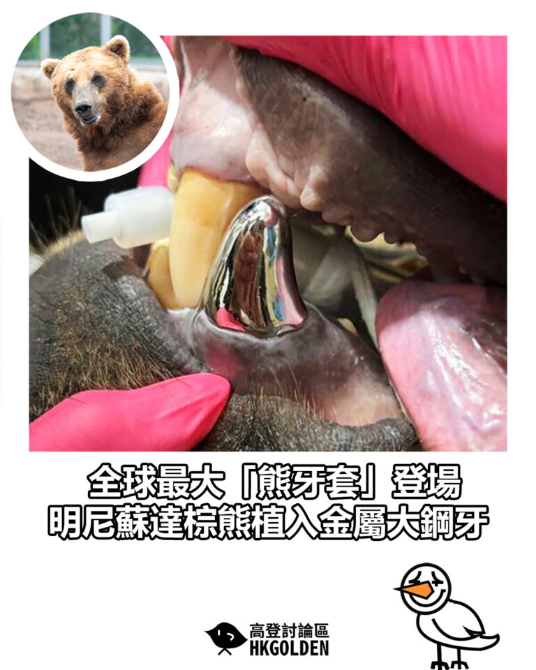 【全球最大「熊牙套」登場　明尼蘇達棕熊植入金屬大鋼牙】