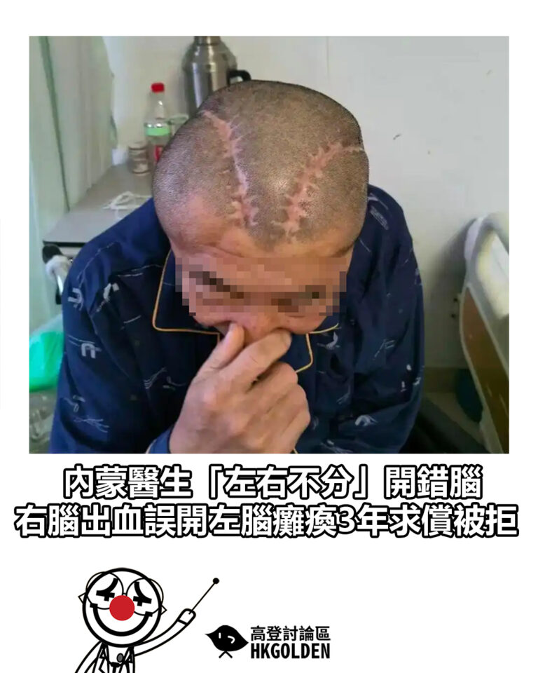 【內蒙醫生「左右不分」開錯腦 右腦出血誤開左腦癱瘓3年求償被拒】