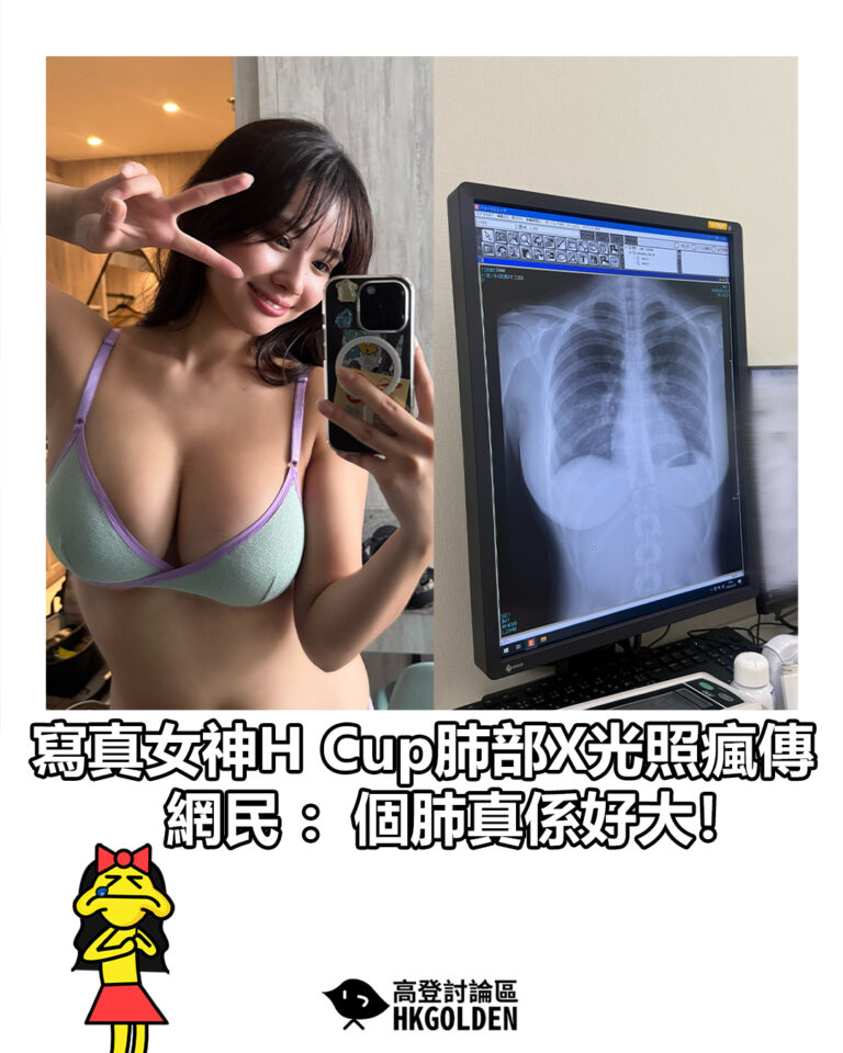 【寫真女神H Cup肺部X光照瘋傳 網民：個肺真係好大！】