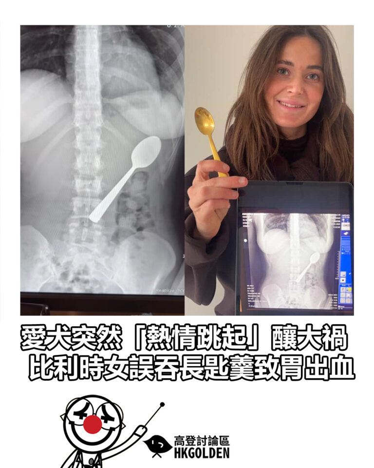 【愛犬突然「熱情跳起」釀大禍  比利時女誤吞長匙羹致胃出血】