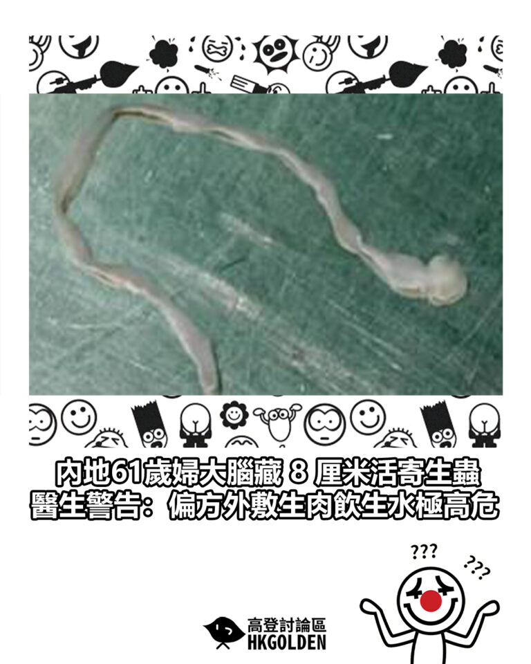 【內地61歲婦大腦藏 8 厘米活寄生蟲 醫生警告:偏方外敷生肉飲生水極高危】 【內地61歲婦大腦藏 8 厘米活寄生蟲 醫生警告:偏方外敷生肉飲生水極高危】