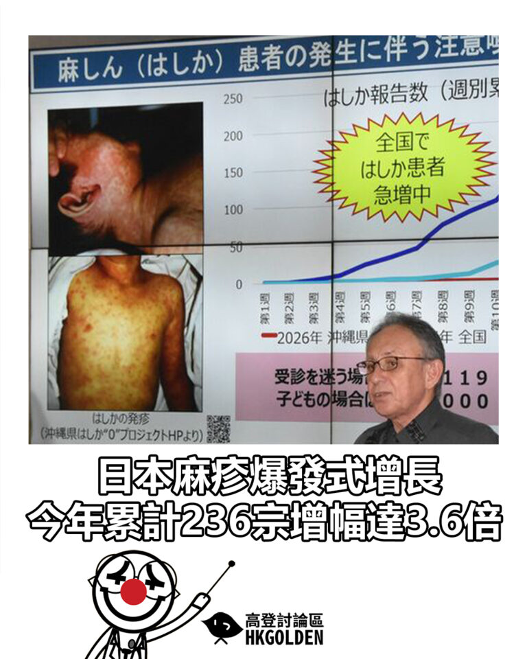 【日本麻疹爆發式增長 今年累計236宗增幅達3.6倍】 【日本麻疹爆發式增長 今年累計236宗增幅達3.6倍】