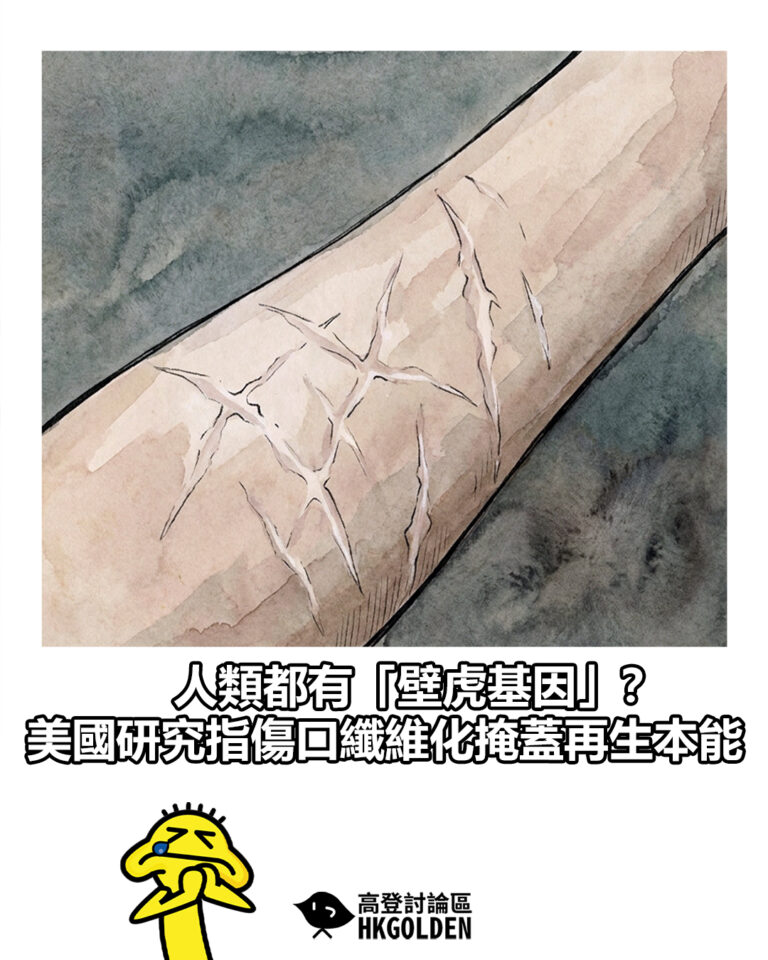 【人類都有「壁虎基因」？ 美國研究指傷口纖維化掩蓋再生本能】