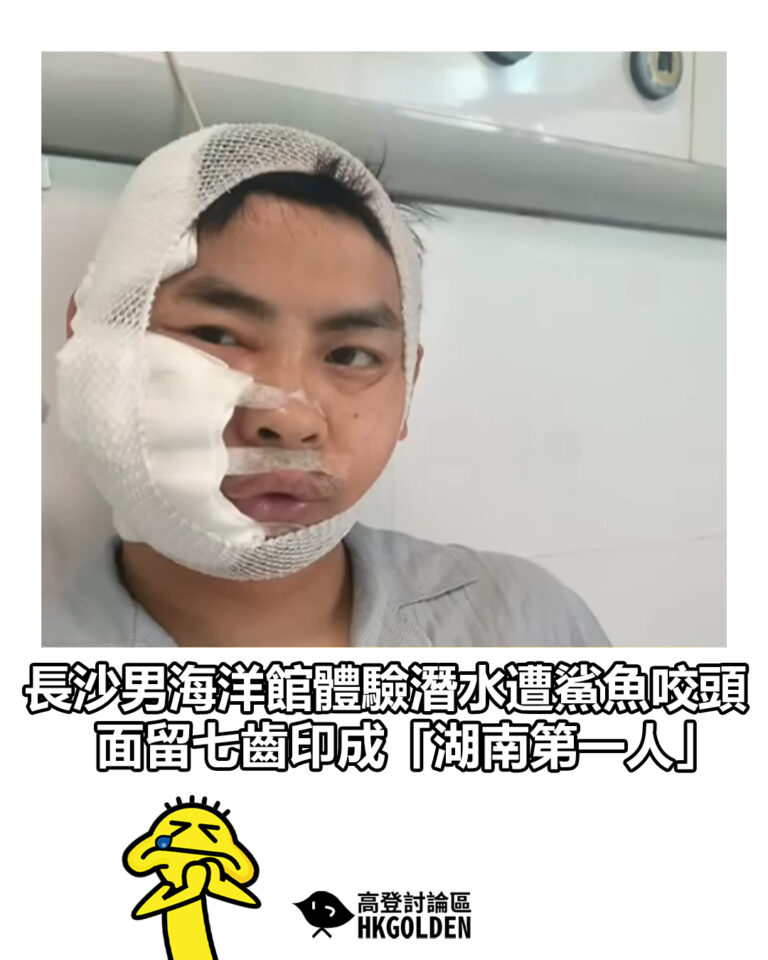 【長沙男海洋館體驗潛水遭鯊魚咬頭 面留七齒印成「湖南第一人」】
