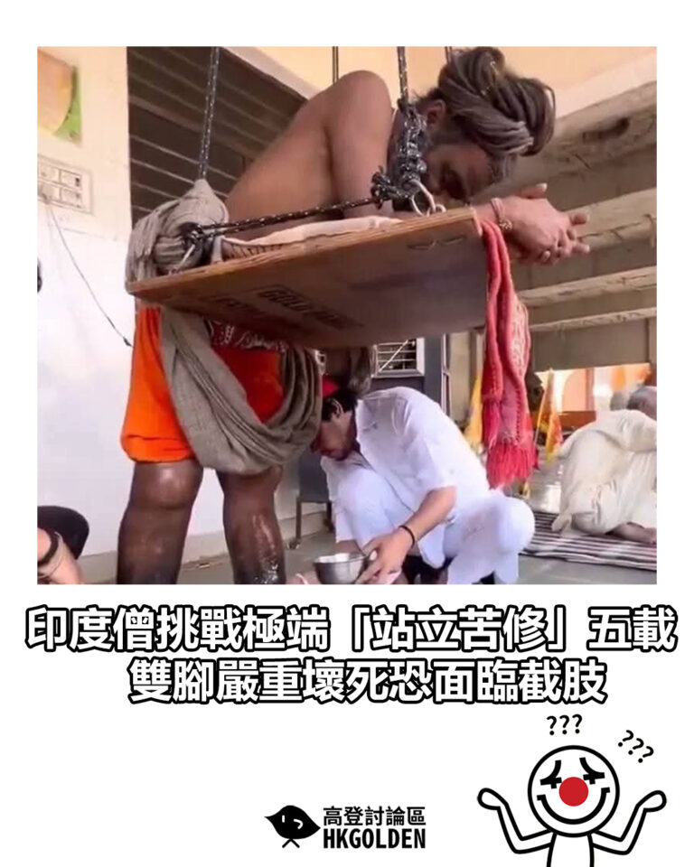 【印度僧挑戰極端「站立苦修」五載 雙腳嚴重壞死恐面臨截肢】