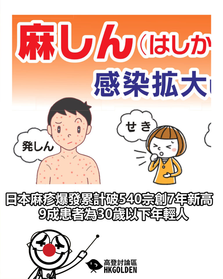【日本麻疹爆發累計破540宗創7年新高 9成患者為30歲以下年輕人】 【日本麻疹爆發累計破540宗創7年新高 9成患者為30歲以下年輕人】