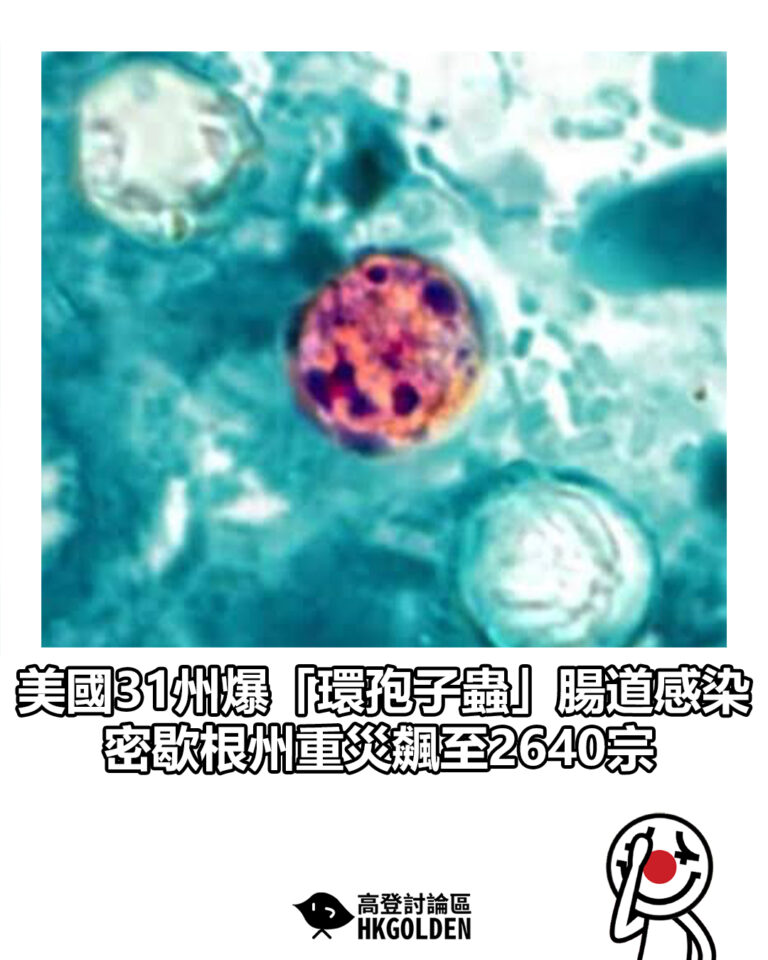 【美國31州爆「環孢子蟲」腸道感染 密歇根州重災飆至2640宗】 【美國31州爆「環孢子蟲」腸道感染 密歇根州重災飆至2640宗】